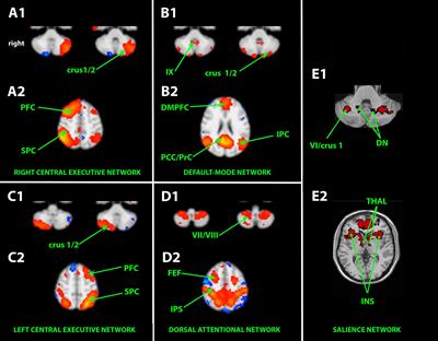 Functional Connectivity of the Cognitive Cerebellum